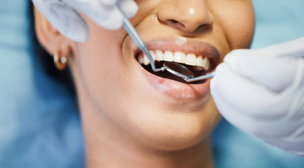 Best Broken or Chipped Tooth Repair in Bluefield, WV